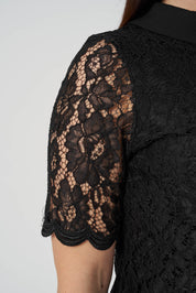 Düğme Detaylı Dantel Elbise Siyah